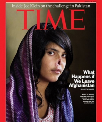 Afgāniete, kura ar savu izskatu šokēja pasauli, atguvusi skaistumu FOTO (Bilde 1)