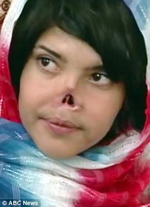 Afgāniete, kura ar savu izskatu šokēja pasauli, atguvusi skaistumu FOTO (Bilde 2)